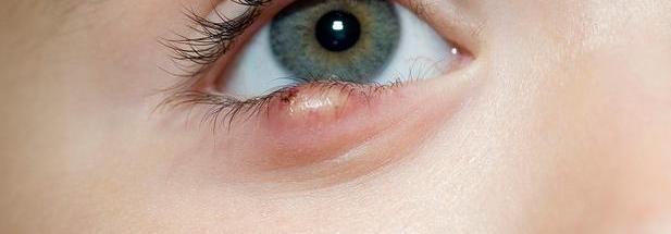 从眼睛就能看到全身的疾病,眼睛反应出来的5种疾病你看到了吗?