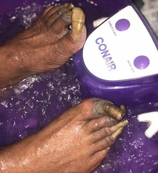 詹姆斯的脚趾 奥尼尔的脚趾 杜兰特的脚趾 诠释了天道酬勤一词