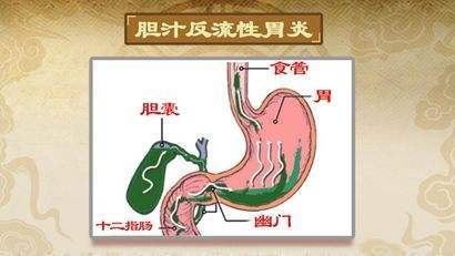 当碱性的十二指肠液与酸性的胃液中和,ph值靠近中性时,胰酶被激活