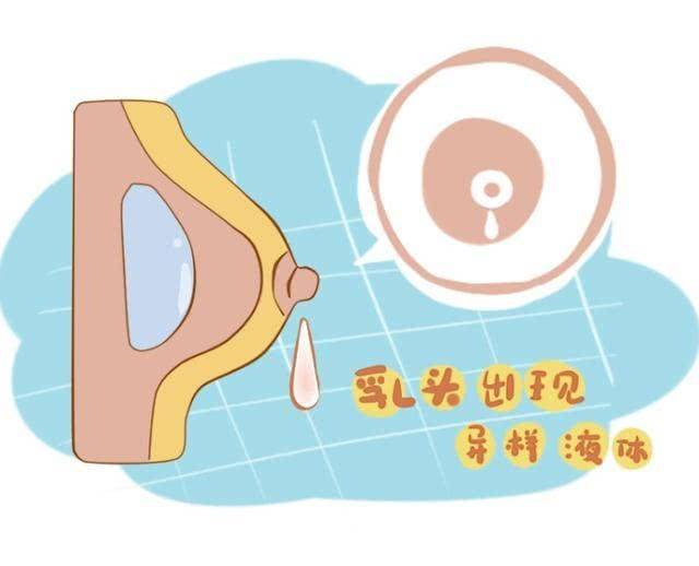 好比酒窝状,橘皮样变化等,都是典型的乳腺癌信号