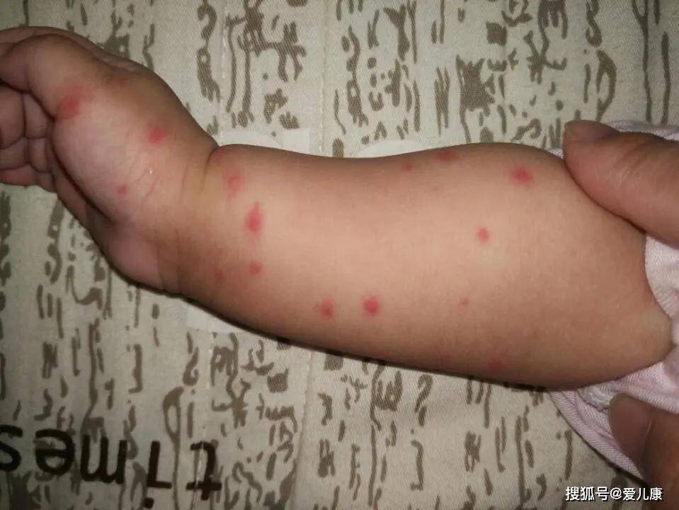 「宝宝」家长别踩坑了...蚊子又来骚扰宝宝了！这些驱蚊方式不靠谱