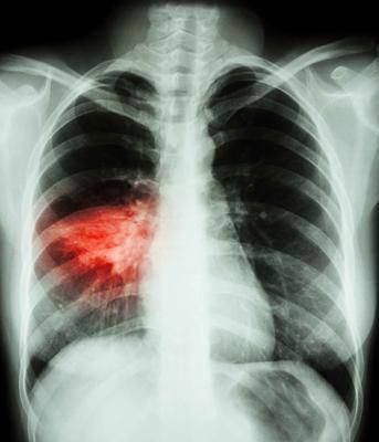 f57fa3006d7d4d70b2673ecf48a93796.jpeg