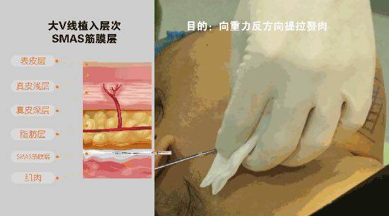 b85ebe640adb4c8598f037bc4d9c3b1f.jpeg