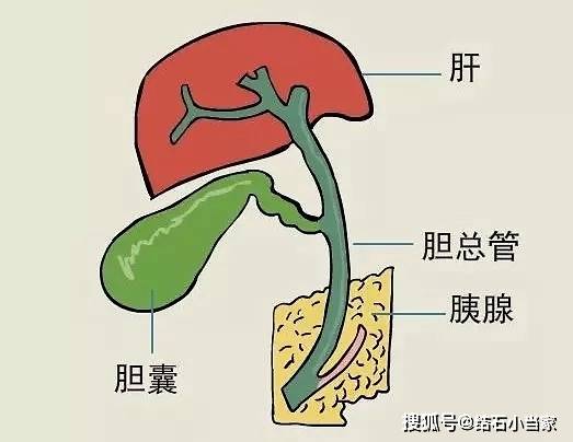 胆结石如何治疗效果比较好记住这七忌和五要