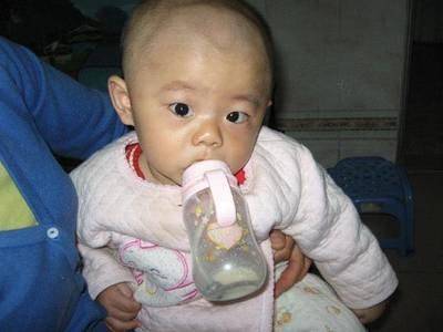 孩子|是积食了！家长带娃多做2事，娃脾胃好，积食消孩子有4种现象