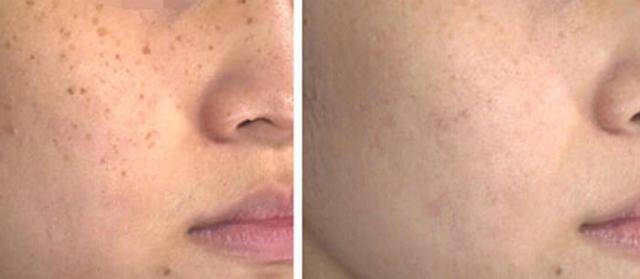 皮肤修复需要多少天 894d503f11dc4742a296d90c73679909.jpeg