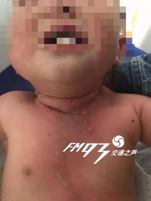 消化道|孩子消化道出血！这种“好东西”，千万别给孩子吃!一口“神仙水”