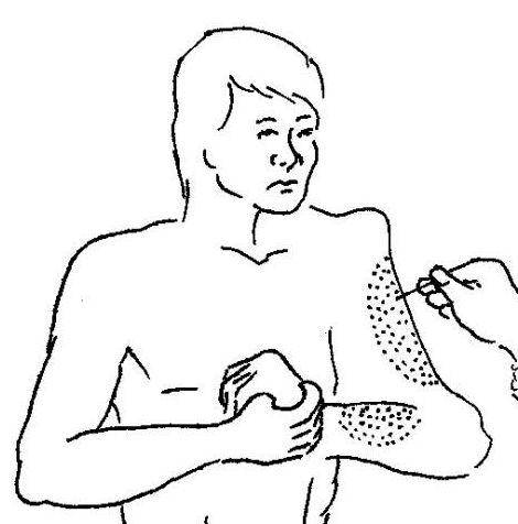 什么办法治偏瘫 7343bc0f72e74d0bab4777a3a94c247e.jpeg