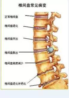 108种内脏病源于"脊椎错位",对应图解只发一次---值得