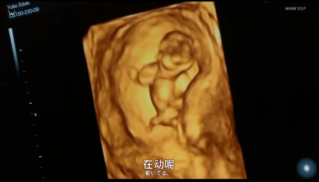 原创70岁生第一个孩子，是什么样的体验？