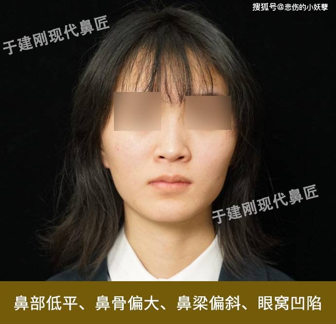 人是富贵还是贫穷,即使是亲兄弟面相也会有一定的差别,就拿鼻子来讲吧