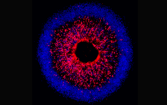 3cc4854736084e8bb978b08eb7e1b8c3.png