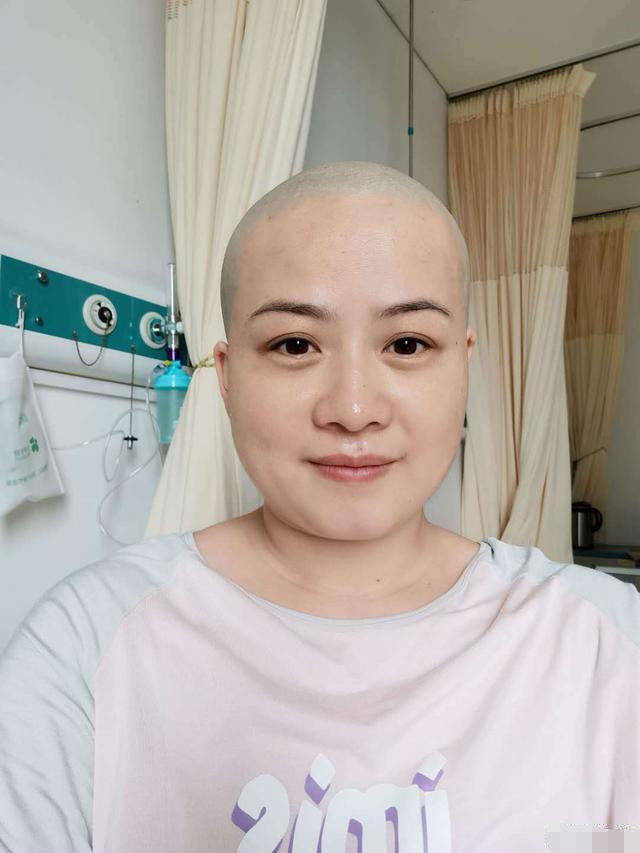 郑敏剃光头准备做手术，德云社集体送祝福，岳