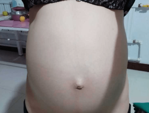 为什么没有胎心了还不出血 8a45a834566c44c895242d91f2026854.png