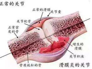 [膝盖疼痛如何治疗]纪老师:为什么膝盖疼?