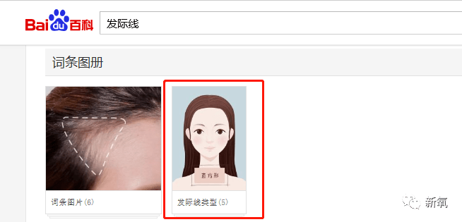 虞书欣不是才24岁吗?怎么就秃成这样了…