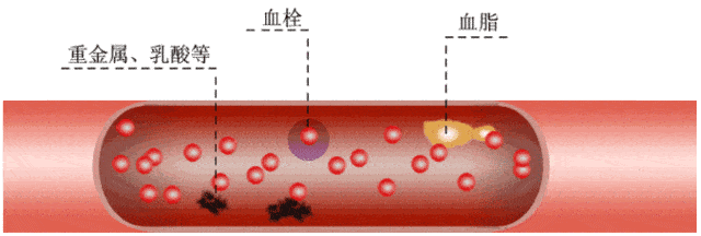长期不注意科学健康的生活方式血管里的毒素容易增加