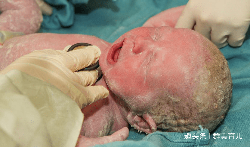 孩子|生出“牛奶娃娃”，吓坏爸爸，医生知道后笑了怀胎十月