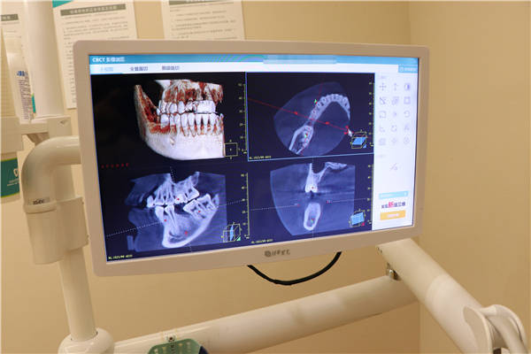 进行种植牙术前,患者需拍摄ct全景片.