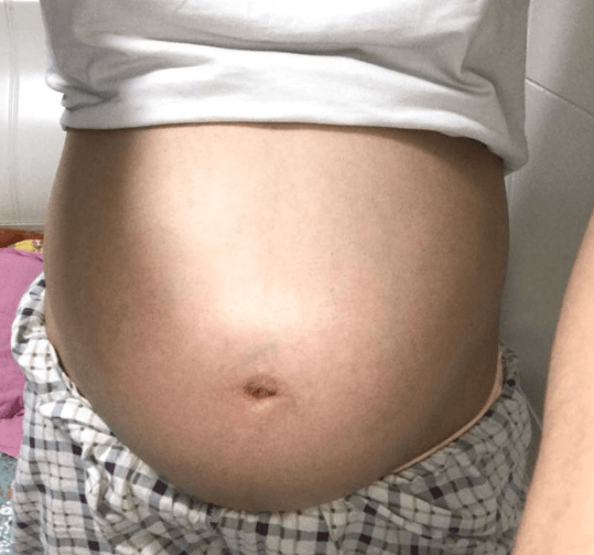 胚胎:早孕体质下降,胚胎被母体排斥,准妈妈犯小错误