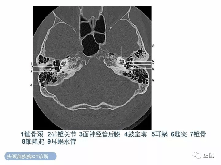 鼓部,乳突部,岩部,茎突颞骨组成