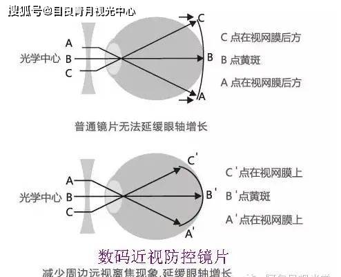 美国休斯敦大学视光学院smith教授的近视发展理论指出,配戴框架眼镜