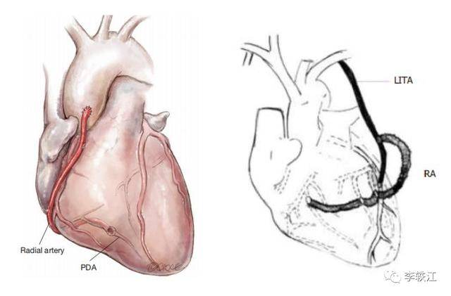 心脏搭脉怎么治疗_心脏位置
