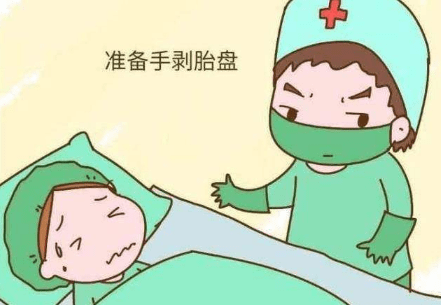 什么情况下需要手剥胎盘？男医生在妇产科工作合适吗？