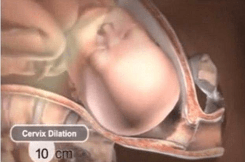 為母則剛！一個足月的胎兒，是怎麼從媽媽肚子裡出來的。《網路文章》