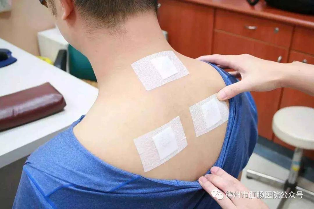 原创德州市肛肠医院 "冬病夏治"三伏贴即将开始了,你准备好了吗?