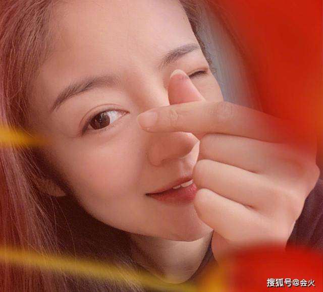 品牌|安以轩点外卖意外烫伤，大腿留下伤疤，发文呼吁餐饮行业引起重视