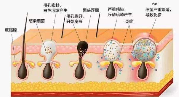 男人皮肤爱出油的7大原因，你占了几条？男性 1739