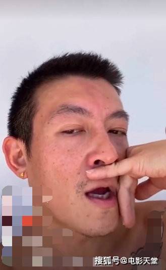 满脸黑痣：面相学、医学与命运的交织探讨（满脸都是黑痣是什么命）