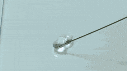 乔雅登|你与女神的小V脸，可能就是一个下巴的距离！