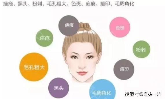 什么是刷酸?毛孔粗大可以通过刷酸解决吗?