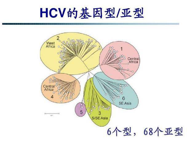 丙肝索非布韦联合莱迪帕韦，HCV合并4-5期慢性肾病，12周安全有效