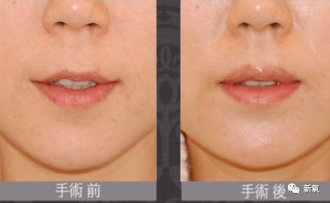 人中|20岁的脸垮得像40岁，还比关晓彤讨人喜欢，她真没不服气吗？