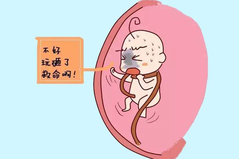 宝宝脐带绕颈后,妈妈会有什么感觉?