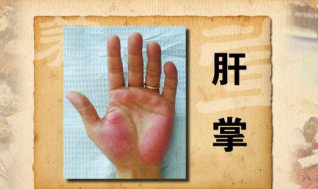 怎样调理肝脏排毒功能 4b7fff3891594c12af6c77ca45686aa5.jpeg