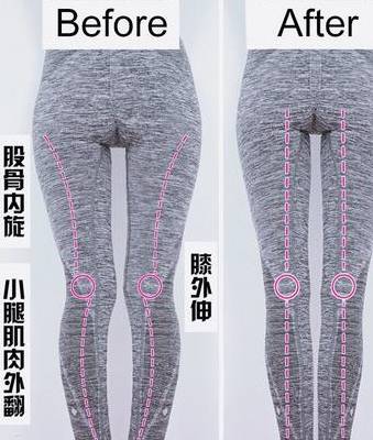 o型腿矫正动作床上 52e70bfb2fa84aaea997ae44ead971e4.jpeg