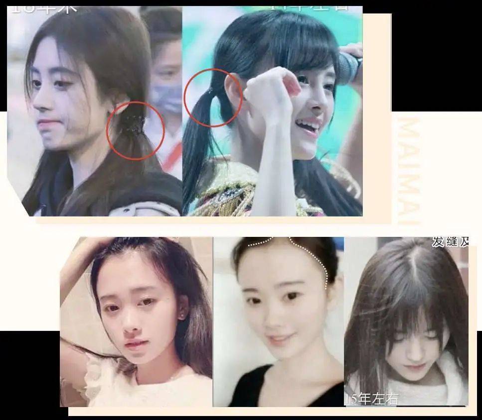 双眼皮|景甜整容整成了“悲伤蛙”，还有比这更悲伤的吗？