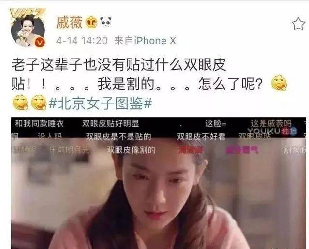 双眼皮|景甜整容整成了“悲伤蛙”，还有比这更悲伤的吗？