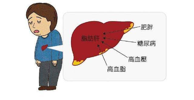 高血脂是怎么引起的啊 e6cad092223c4c06b4a5366fc989966c.jpeg