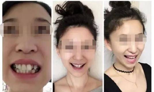 牙齿|90后的你想过什么样的老年生活？网友：吃喝玩乐样样不落！