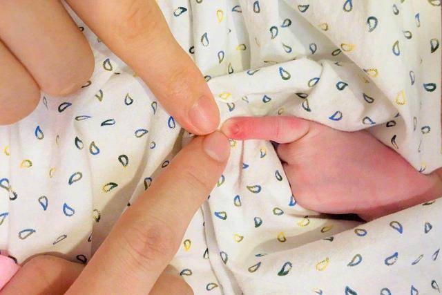 原创如果宝宝被查出“异常”，孕妈妈应不应该将其留下，是自私还是爱