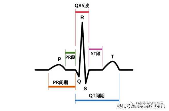 如何快速阅读心电图?记住这些技巧事半功倍!(文章)