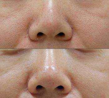 肌肤|别再跟风买了！油皮的【本命水】你喝对了吗？