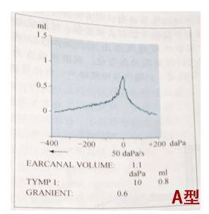 在a型鼓室声导抗图中,又根据峰值的幅度大小分为ad和as两个亚型:as型