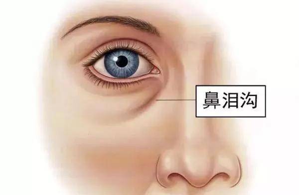 女明星|女明星“眼下增肥”是什么操作？