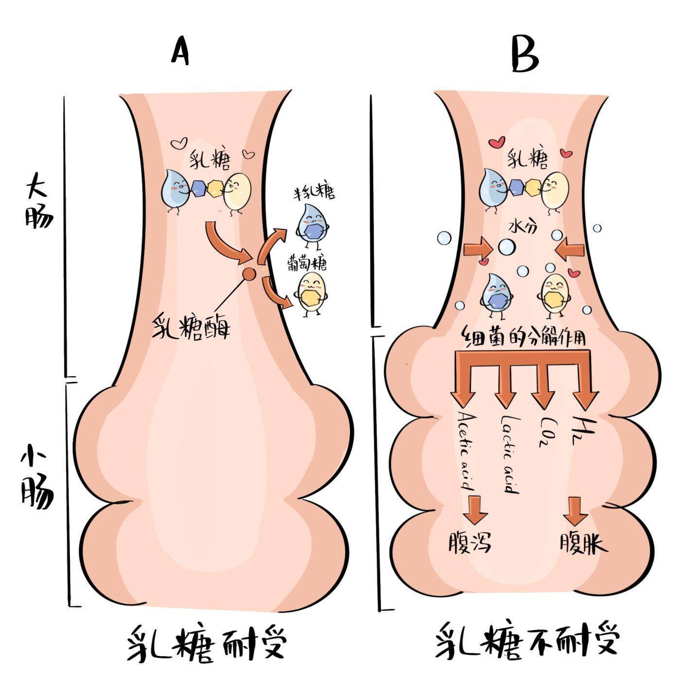 乳糖不耐症佔人口比例_乳糖不耐症大便照片